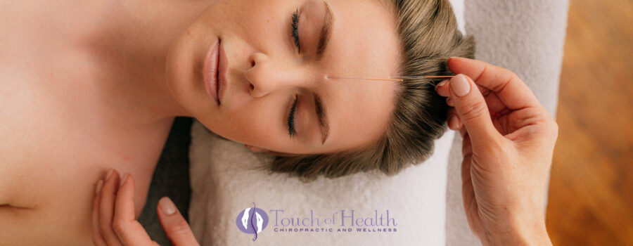 Revitalize and Rejuvenate Your Skin with Cosmetic Acupuncture
